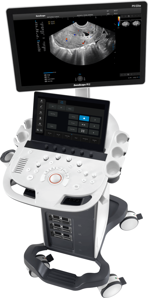Sonoscape P9 Elite Vet - фото - 1
