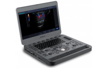 sonoscape X5 - фото - 1